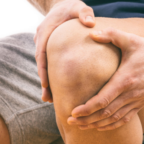 Knie